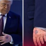 El Presidente Trump enfrenta un nuevo desafío en Washington: los detalles del incidente que le causó la lesión facial y las implicaciones políticas para su mandato.